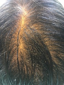 シリコン病 髪の毛の根元がフワッとしない 髪の毛が乾きづらい 髪の毛のトラブル
