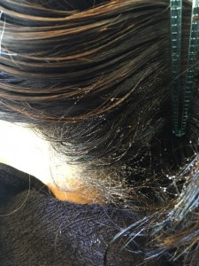 シリコン病 シリコーンリムーバー 美容室 襟足の髪の毛のクセ 原因
