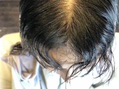 前髪のクセ 縮毛矯正 美容室　りずむヘアデザイン 土浦市
